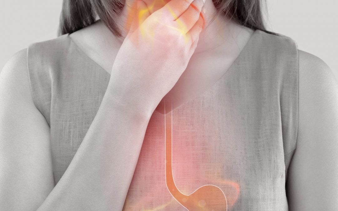 10 Tips to Manage Heartburn and Reflux